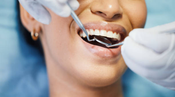 Best Emergency Tooth Extraction in Tunnel Hill, GA