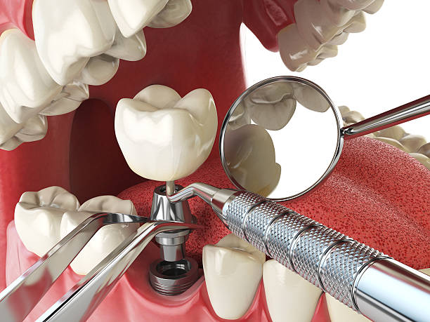 Best Emergency Dental Surgery in Tunnel Hill, GA