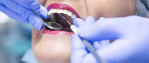 Best Emergency Treatment for Toothache in Tunnel Hill, GA